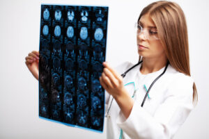 Kobieta neurolog sprawdzająca wyniki badań rentgenowskich mózgu.